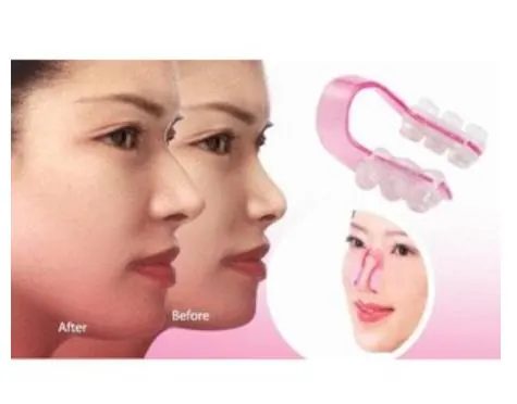 Nose UP Alat Pemancung Hidung
