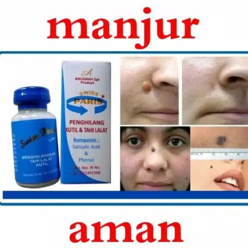 Swiss Paris Lotion penghilang tahi lalat,kutil BPOM bisa GOJEK