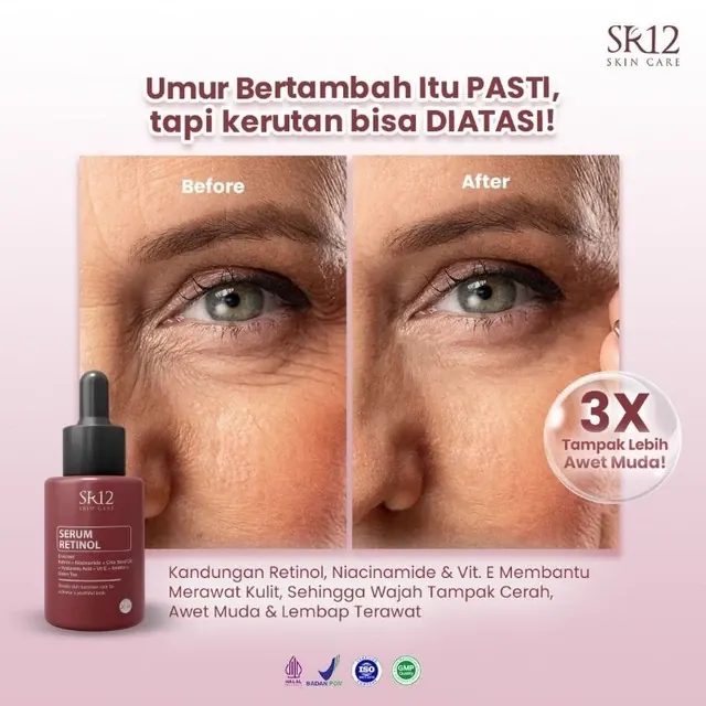 (Momq) Serum retinol SR12 mencegah penuaan dini menghaluskan kerutan