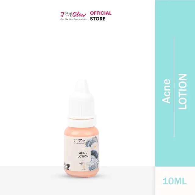 Jglow - Acne Sulfur Lotion Untuk jerawat meradang
